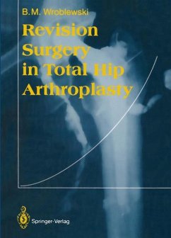 Revision Surgery in Total Hip Arthroplasty - Wroblewski, Boguslaw M.