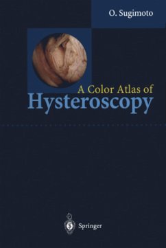 A Color Atlas of Hysteroscopy - Sugimoto, Osamu