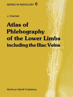 Atlas of Phlebography of the Lower Limbs - Chermet, J.