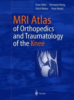 MRI Atlas of Orthopedics and Traumatology of the Knee - Teller, Peter;König, Hermann;Weber, Ulrich