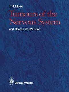 Tumours of the Nervous System - Moss, Timothy H.