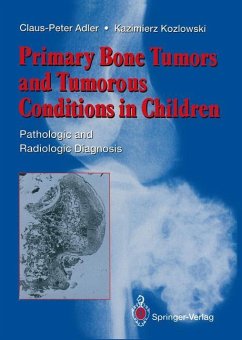 Primary Bone Tumors and Tumorous Conditions in Children - Adler, Claus-Peter;Kozlowski, Kazimierz