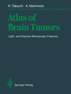 Atlas of Brain Tumors - Tabuchi, Kazuo; Nishimoto, Akira