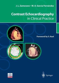 Contrast Echocardiography in Clinical Practice - García Fernández, Miguel A.;Zamorano, Jose L.