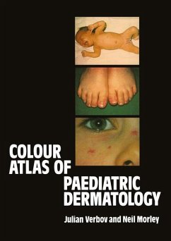 Colour Atlas of Paediatric Dermatology - Verbov, Julian;Morley, W. N.