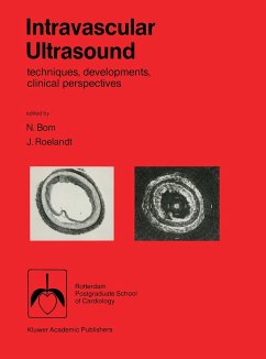 Intravascular ultrasound