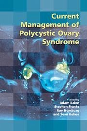 Current Management of Polycystic Ovary Syndrome