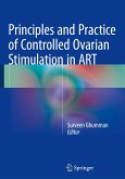 Principles and Practice of Controlled Ovarian Stimulation in ART