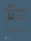 Hip Fractures