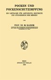 Pocken und Pockenschutzimpfung Pocken und Pockenschutzimpfung