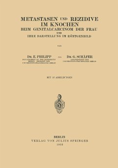 Metastasen und Rezidive im Knochen - Philipp, E.;Schäfer, G.