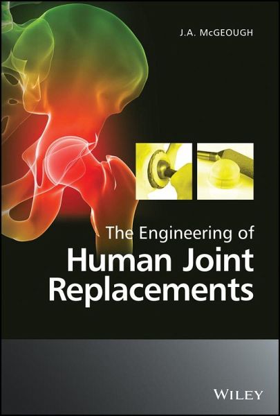 The Engineering of Human Joint Replacements (eBook, PDF) The Engineering of Human Joint Replacements (eBook, PDF)