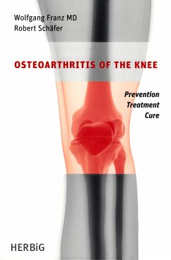 Osteoarthritis of the knee (eBook, ePUB) - Franz, Wolfgang; Schäfer, Robert