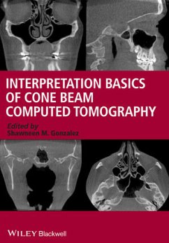 Interpretation Basics of Cone Beam Computed Tomography (eBook, PDF) - Gonzalez, Shawneen M.