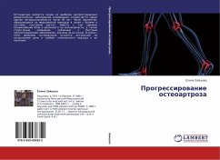 Progressirowanie osteoartroza