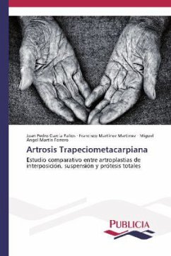 Artrosis Trapeciometacarpiana - Garcia Paños, Juan Pedro;Martinez Martinez, Francisco;Martín Ferrero, Miguel Angel