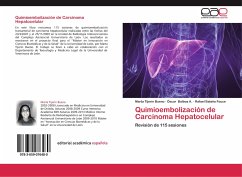 Quimioembolización de Carcinoma Hepatocelular