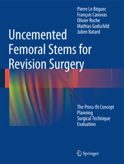 Uncemented Femoral Stems for Revision Surgery