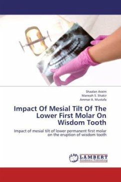 Impact Of Mesial Tilt Of The Lower First Molar On Wisdom Tooth