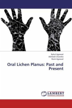 Oral Lichen Planus: Past and Present