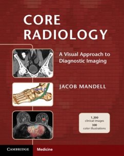 Core Radiology (eBook, PDF) - Mandell, Jacob