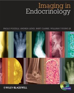 Imaging in Endocrinology (eBook, PDF) - Pozzilli, Paolo; Lenzi, Andrea; Clarke, Bart L.; Young, William F.