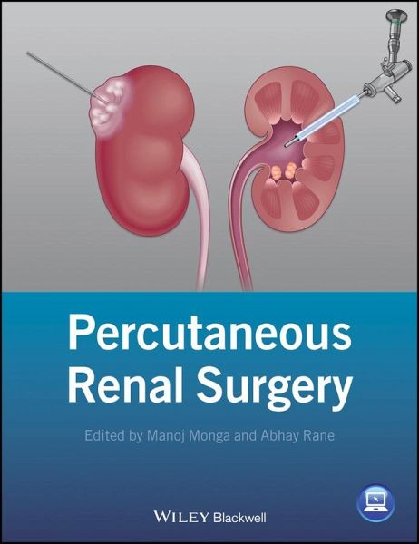 Percutaneous Renal Surgery (eBook, ePUB)