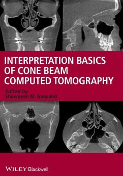 Interpretation Basics of Cone Beam Computed Tomography (eBook, ePUB) - Gonzalez, Shawneen M.