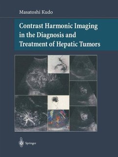 Contrast Harmonic Imaging in the Diagnosis and Treatment of Hepatic Tumors - Kudo, Masatoshi