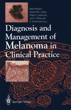 Diagnosis and Management of Melanoma in Clinical Practice