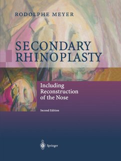 Secondary Rhinoplasty - Meyer, Rodolphe