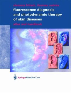 Fluorescence Diagnosis and Photodynamic Therapy of Skin Diseases - Fritsch, Clemens;Ruzicka, Thomas