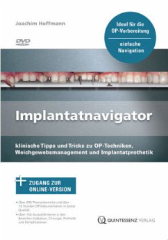 Implantatnavigator, DVD-ROM