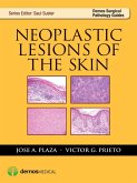 Neoplastic Lesions of the Skin (eBook, ePUB)