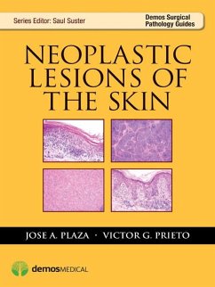 Neoplastic Lesions of the Skin (eBook, ePUB) - Plaza, Jose A.; Prieto, Victor G.