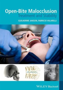 Cover Open-Bite Malocclusion (eBook, ePUB)