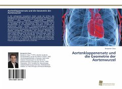 Aortenklappenersatz und die Geometrie der Aortenwurzel - Claus, Benjamin