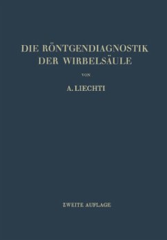 Die Röntgendiagnostik der Wirbelsäule und ihre Grundlagen - Liechti, Adolf