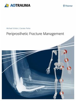 Periprosthetic Fracture Management - Schütz, Michael;Perka, Carsten