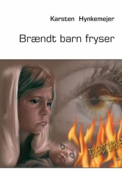 Brændt barn fryser