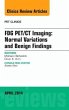 Fdg Pet/CT Imaging: Normal Variations... - Bild 1