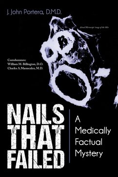 Nails That Failed - Portera D. M. D., J. John