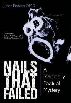 Nails That Failed - Portera D. M. D., J. John