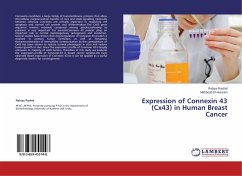 Expression of Connexin 43 (Cx43) in Human Breast Cancer