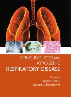 Cover Drug-induced and Iatrogenic Respiratory Disease (eBook, PDF)