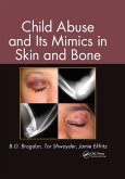 Child Abuse and its Mimics in Skin and Bone (eBook, ePUB)