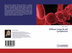 Diffuse Large B-cell Lymphoma