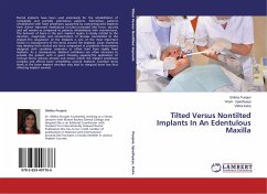 Tilted Versus Nontilted Implants In An Edentulous Maxilla - Punjani, Shikha;Upadhyaya, Viram;Kalra, Vibha