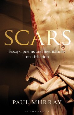 Scars - Murray, Dr. Paul, O. P.