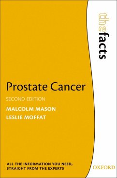 Prostate Cancer (eBook, PDF) - Mason, Malcolm; Moffat, Leslie
